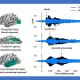 Graphic from a Johns Hopkins Medicine and University of Maryland study showing brain electrical activity analyzed by magnetoencephalography (MEG). The patterns show that patients with minor strokes (blue) have reduced signaling ability between different brain regions when compared to normal controls (black). Credit: Johns Hopkins Medicine