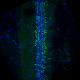 Image credit:  Wendy Yue / UCSF
UCSF scientists have discovered a new molecular pathway that controls the formation of scar tissue in spinal cord injuries. In the future, it could be targeted by drugs to promote healing.
