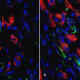 Histology slides show murine heart at five days post-implant a) with conventional non-perfusable vessels and b) with patterned perfusable cardiac construct.