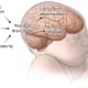 A medical image of an infant shows a sideview of its brain. A flowchart explains that infection and inflammation, hypoxia and ischemia, or prematurity can lead to perinatal brain injury, which can lead to structural abnormalities and neurologic disease.