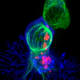 A killer T cell (blue) is engaging a target cell