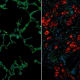 Immunofluorescence images showing healthy (left) and scleroderma (right) lungs. The scleroderma lung shows reduced levels of Cathepsin L (green) and increased levels of fibroblast activation marker (red).