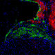 The mouse atrioventricular (AV) node. Green staining indicates AV node cells, while red staining highlights neighboring atrial muscle cells. All cell nuclei are stained blue.