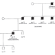 Odom: Prostate cancer is more hereditary than any other cancer. This figure shows the family history of a 49-year-old patient (arrow) seen by urologist Patrick Walsh in the 1980s. The man told Walsh that his father, his father’s three brothers, and his grandfather all died of prostate cancer. This case ignited discovery in the little-known field of prostate cancer genetics at the Brady and began a 30-year hunt for the genes responsible.