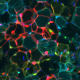 Image: Liang Li, Feldman Lab.
UCSF study finds that suppressing a protein in mice turns fat cells from white to beige, and may explain why drug trials targeting a different protein failed.