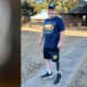 Scott Bryson is back on his feet after undergoing osseointegration surgery at UT Southwestern. The X-ray shows the titanium metal implant set in his leg bone to serve as the base for his prosthetic limb
