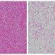 Compared with normal brown fat (left), Ovol2 mutant brown fat (right) is defective in heat production with a massive accumulation of extra lipids (large white holes).