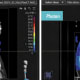 Dose color wash comparison of proton versus photon in axial, sagittal, and coronal planes. Dose distribution to lung, heart, and esophagus are significantly lower in the proton plan.