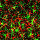 A fluorescent image displays reactive gliosis – a condition found in many neurodegenerative diseases – in the cerebral cortex induced by astrocyte-expressed GADD45G, the protein product of the Gadd45g gene. Reactive astrocytes are shown in red and reactive microglia are green, both common glial cell types.