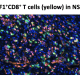 Detection of Tcf1-positive ‘stem-like’ T cells in mouse NSCLC tumors after inhibition of Axl combined with blockade of PD-1. These stem-like T cells are required for response to immune checkpoint blockade. In the absence of Axl inhibition these the Tcf1-positive stem like T cells are not present.