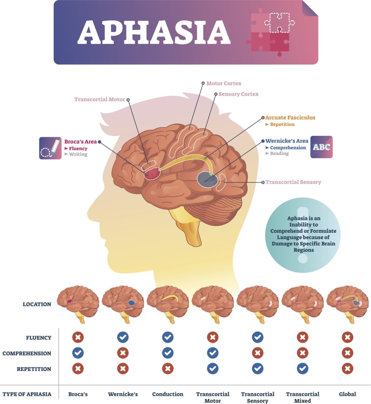 aphasia