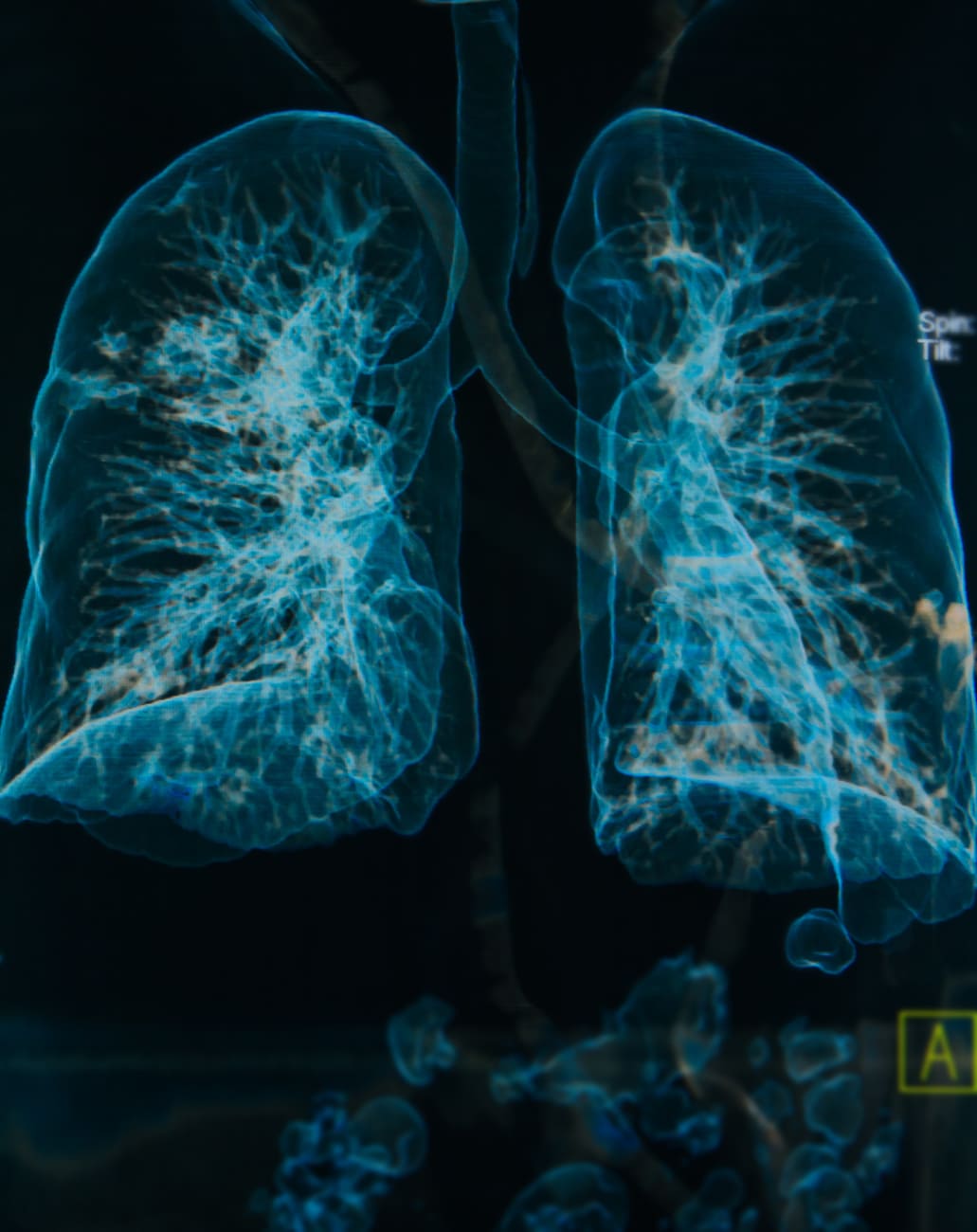 Unraveling Causes and Finding Treatments for COPD