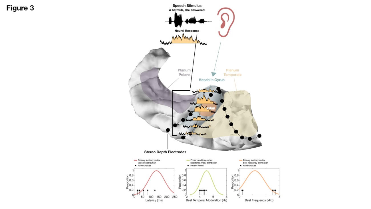 Physiologic measurements taken while the patient listened to prerecorded sentences confirmed that the primary auditory cortex is, in fact, within Heschl’s gyrus 