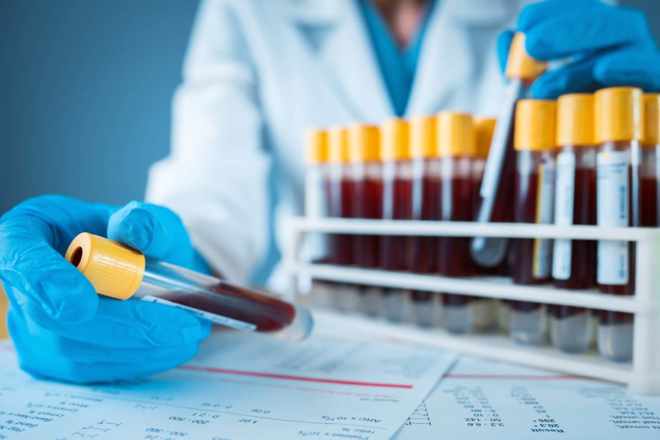 Blood test vials