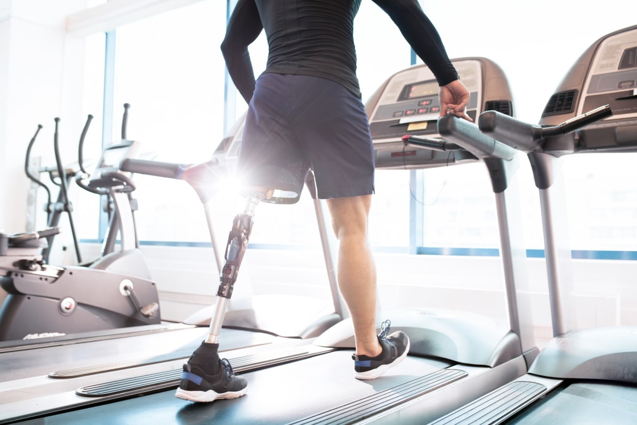 a patient with a prosthetic left leg walks on a treadmill