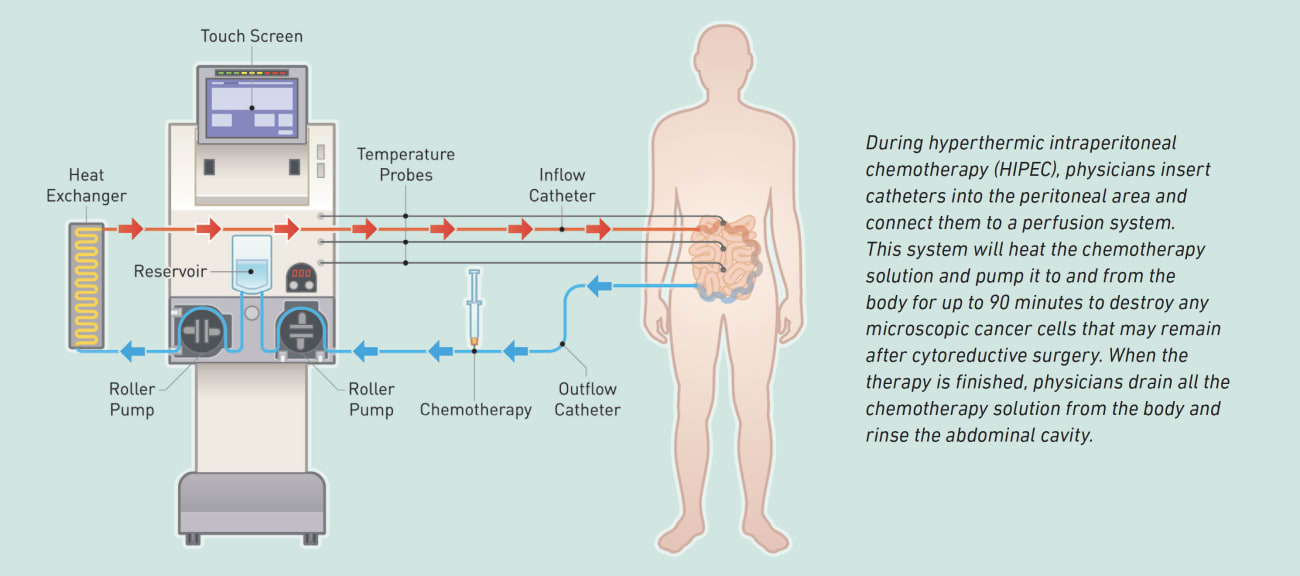 “HIPECDiagram”