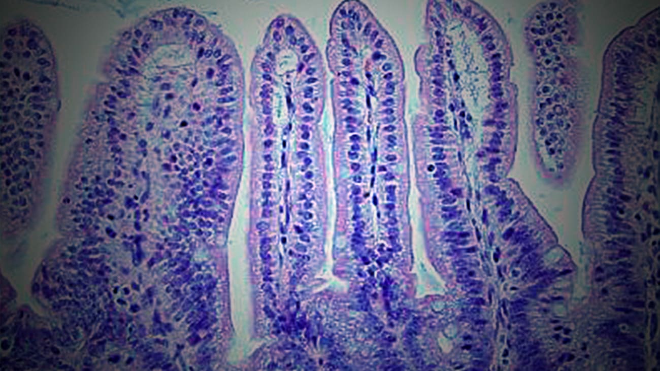 Leading Transformative Change in Graft-Versus-Host Disease Research
