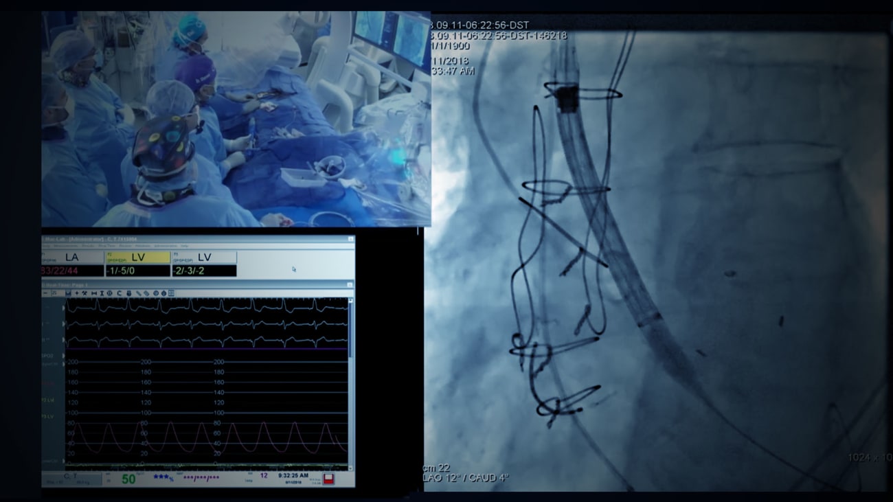 TAVR Procedures at The Mount Sinai Hospital Win Highest Rating From STS/ACC Registry