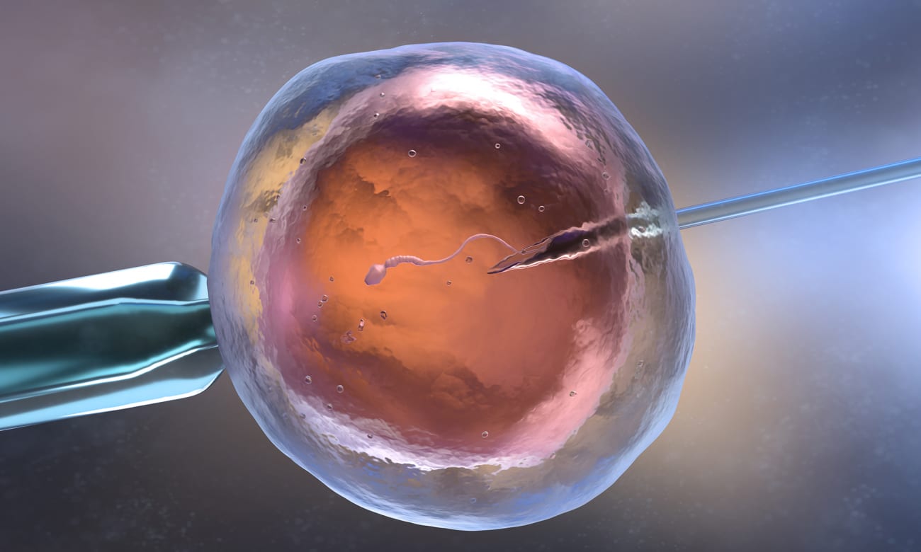 A 3D illustration of artificial semination or in vitro fertilization shows sperm entering an egg from a needle