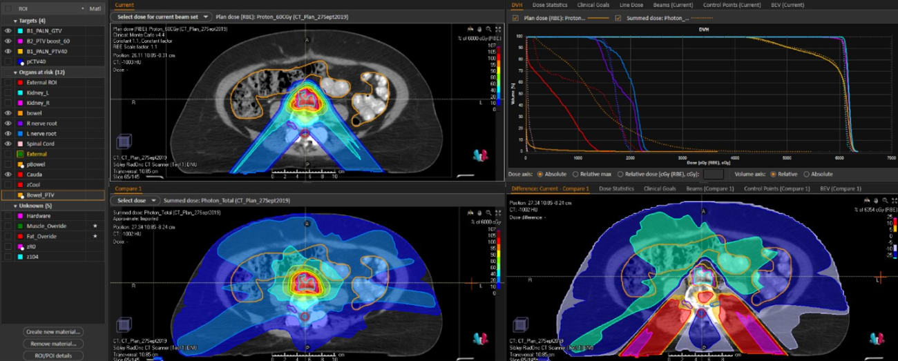 Proton Plan Vs Photon Plan DVH