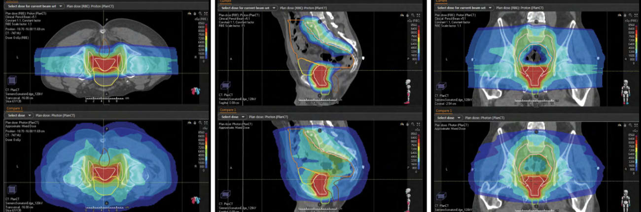 radiation cov figure