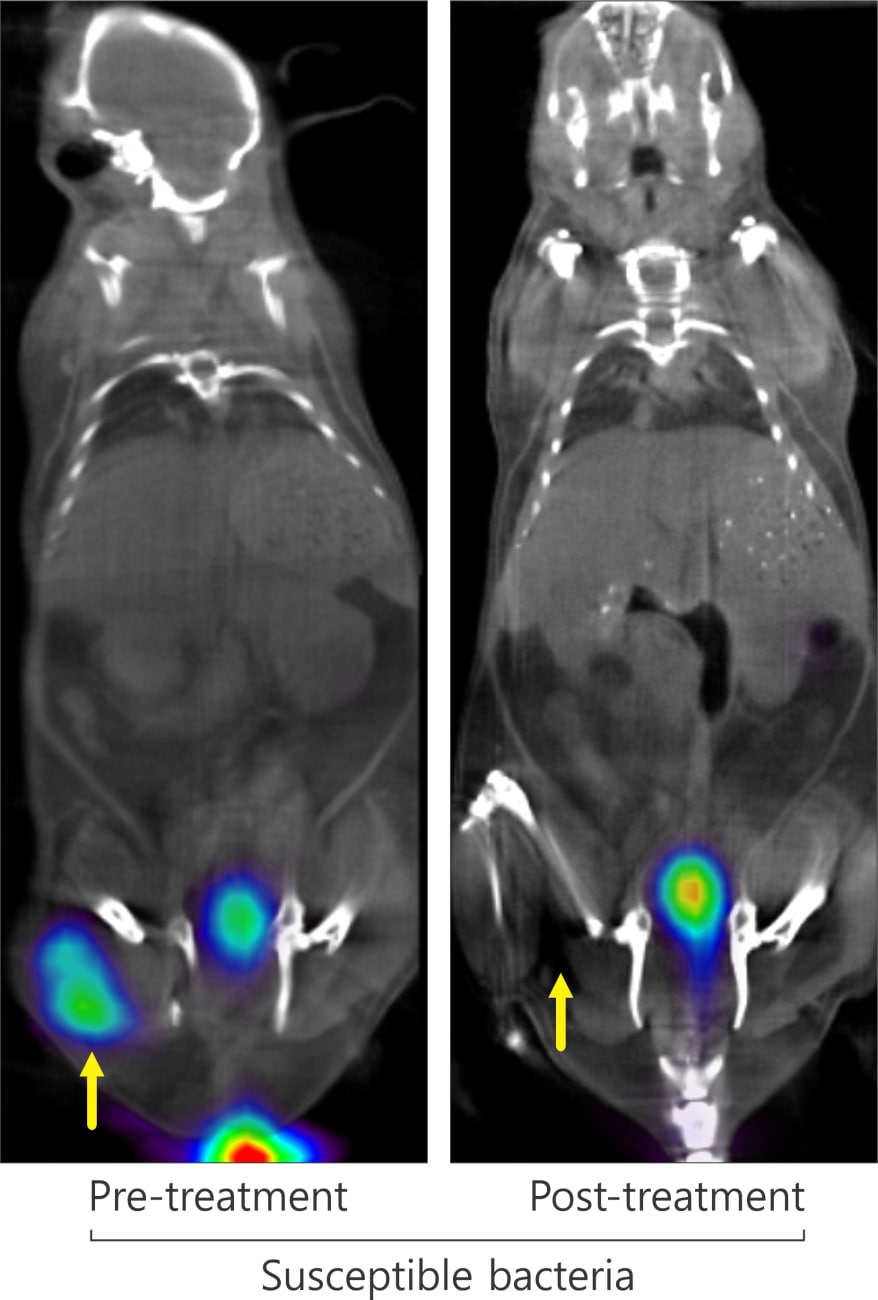 Johns Hopkins Develops New Approach to Target Bacteria Using PET