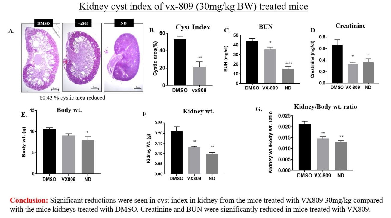 Johns Hopkins Research Shows Potential for Cure for Polycystic Kidney