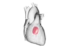 Mitral Valve Anatomy and Echo Evaluation of Mitral Regurgitation