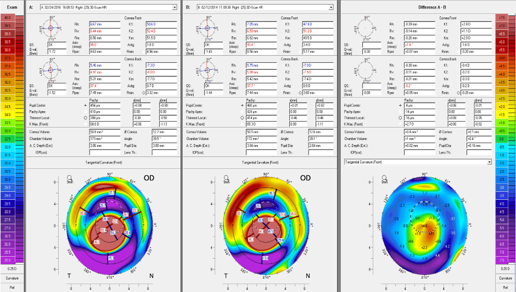 Figure 1. Various customized in-office pamphlets covering a variety of contact lens topics.