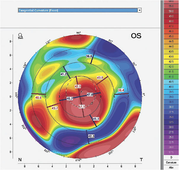 Figure 2. Tangential map.