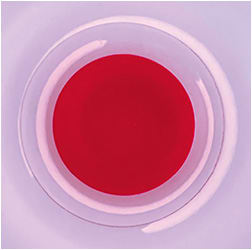Figure 1. A red-tinted lens helps severe photosensitivity in kids who have achromatopsia.