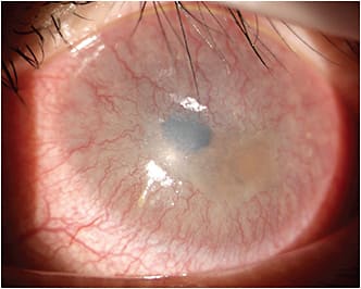 Photo Credit: Photo courtesy of Dr. Michael Everson