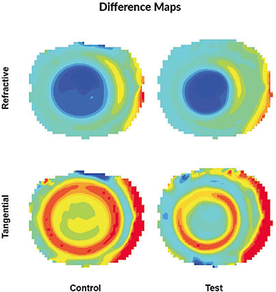 Figure 1. Illustrative topographical outcomes from an OK lens with parameters designed to reduce the central treatment zone diameter (test lens) compared to the standard control lens (Gifford, Kang, et al, 2019).