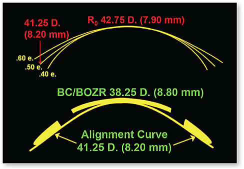 Figure 5. Three corneas with the same R0 but different eccentricities (top). Eccentricity values can be used to determine the curvature of the alignment zone (bottom).