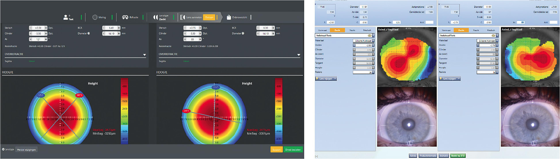 Figure 4. Examples of sophisticated databases of two different large contact lens manufacturers that use uploaded corneal topography maps to match patients’ eyes to thousands of eyes in their database.
