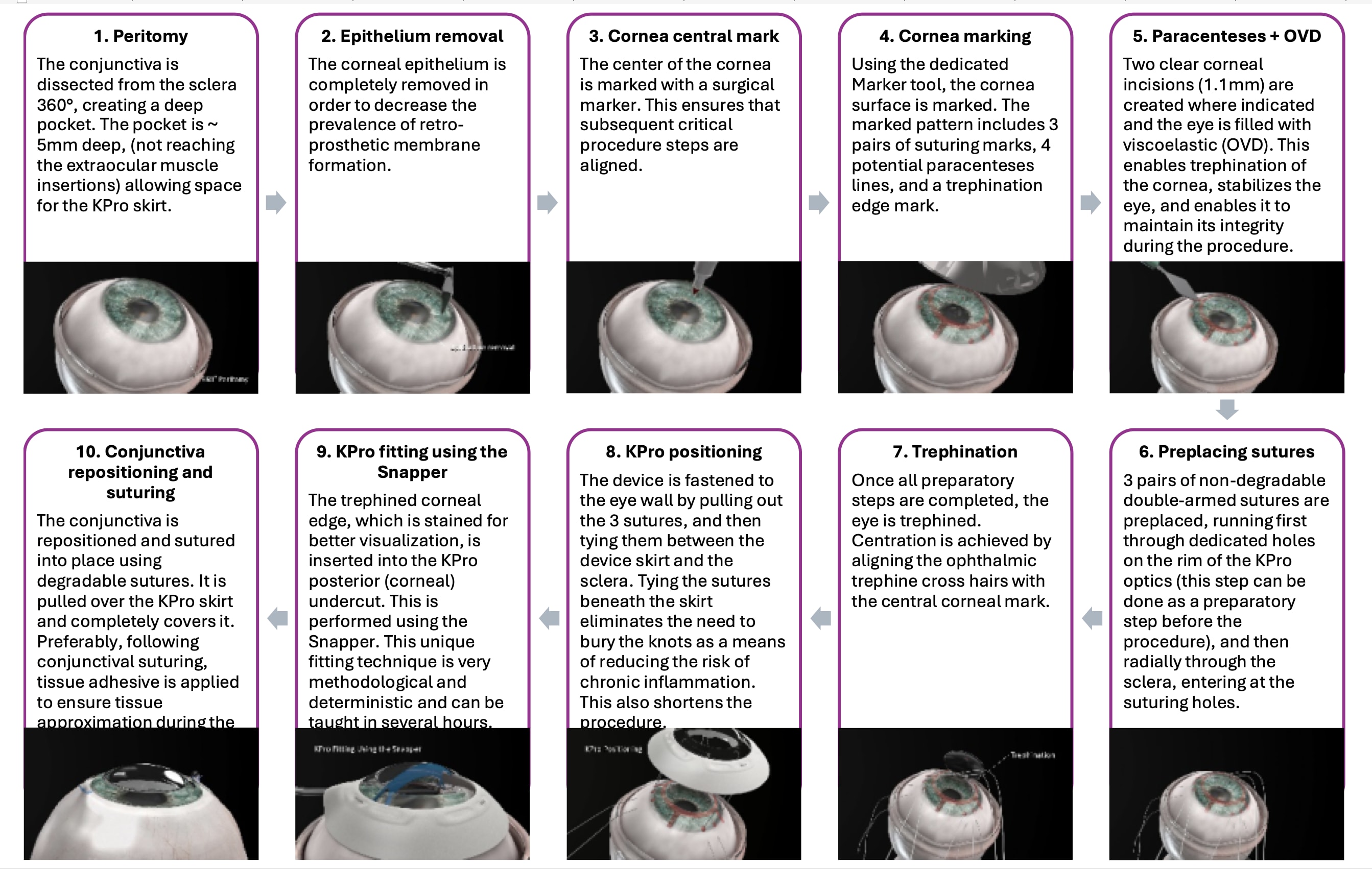 Figure 2. Surgical procedure steps.