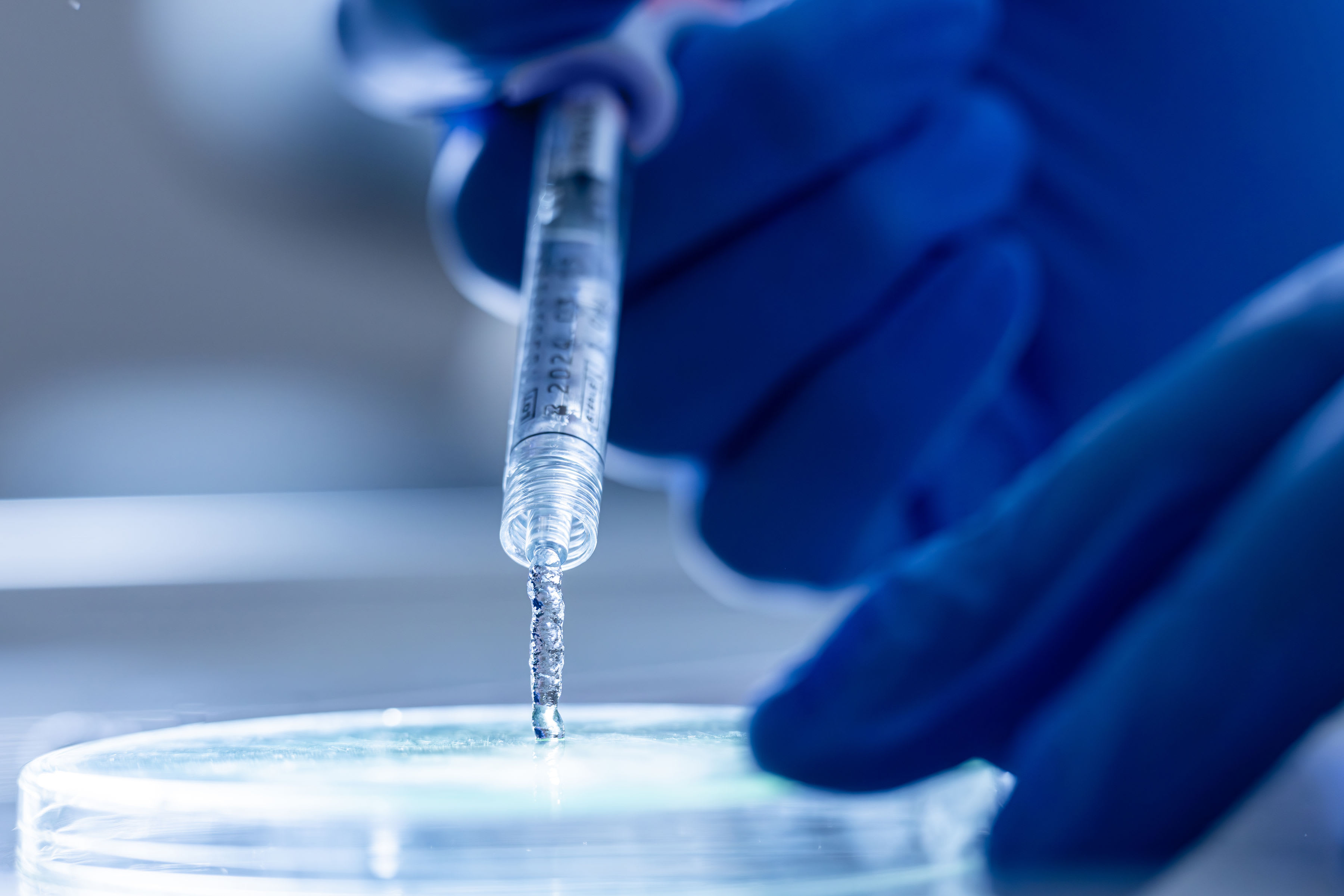 Lacrifill Canalicular Gel is administered through an in-office procedure. Image courtesy of Nordic Pharma, Inc.