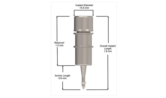 Figure 1. Dose TR intracameral SR implant (Glaukos).