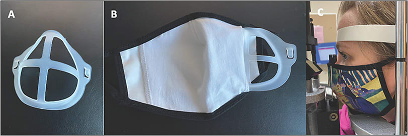 Figure 5. Silicone bracket for face mask rigidity (A). Silicone face mask bracket partially inserted into cloth face mask (B). Cloth face mask with silicone bracket positioned at the slit lamp (C).