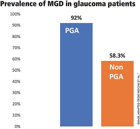 Figure 2. Prostaglandin analogue (PGA) use is closely associated with meibomian gland dysfunction.