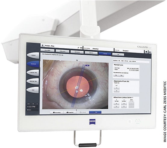 Zeiss’s CALLISTO eye OR management system.