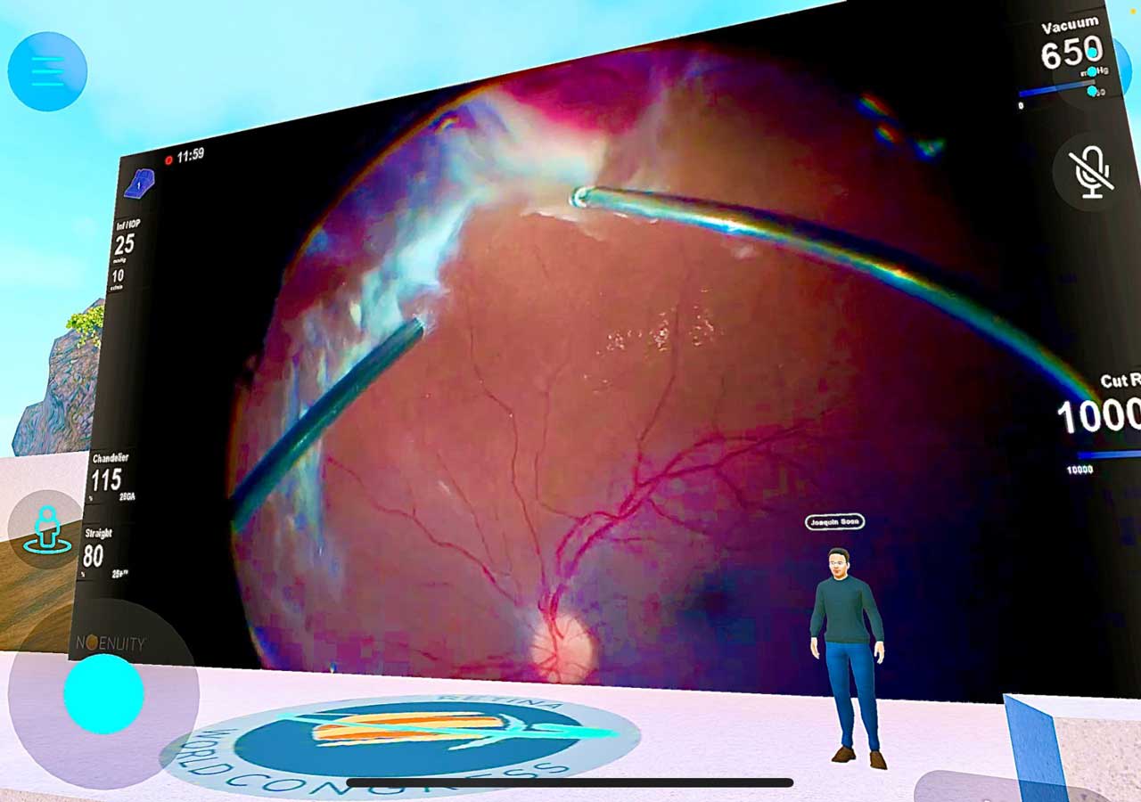 Joaquín Sosa Lockward, MD, reviews a 3D-recorded video of a vitreous hemorrhage and retinal detachment in front of attendees from around the world.