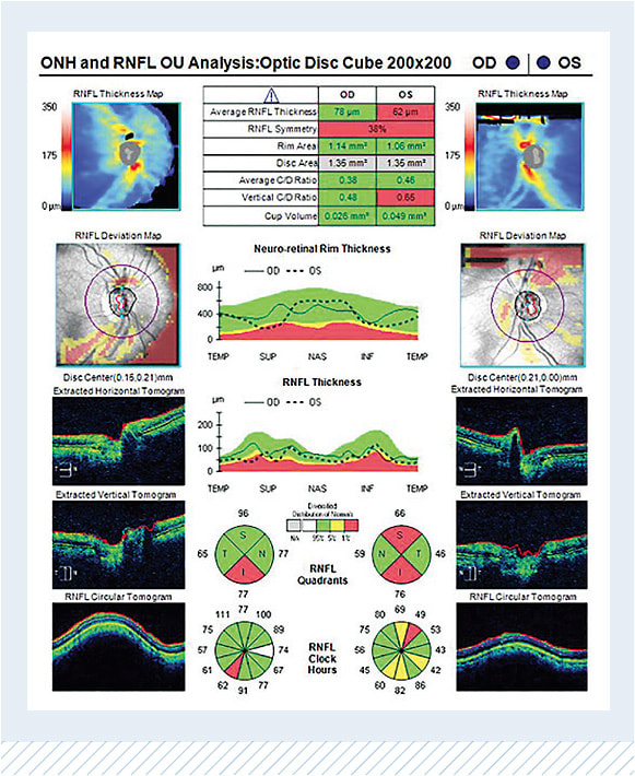 Images courtesy of Dr. Austin Lifferth.