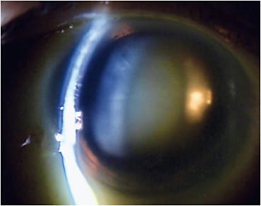 Image courtesy of Dr. Marc Bloomenstein