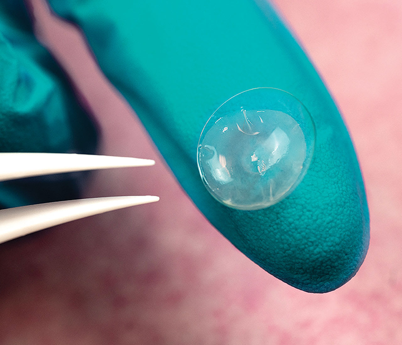 CAM360 AmnioGraft features various healing properties.