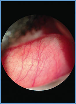 Image courtesy of Dr. Anthony J. Spencer.