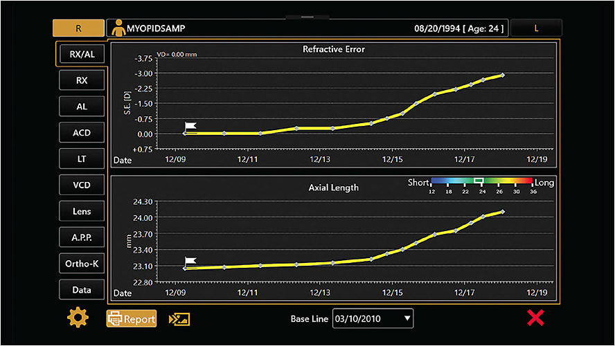 Aladdin-M reports on change in refraction and axial length. Myopia management is best managed by measuring structure and function; monitoring axial length (structure) and refractive error (function) arms the clinician with more information to improve outcomes. Image courtesy of Dr. Pamela Lowe.