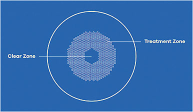 Image courtesy of Hoya Vision Care.