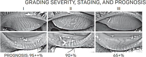 Figure 4. Dr. Epstein’s approach to categorizing patients takes into account severity AND prognosis.