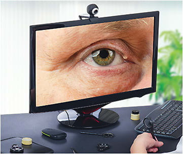 Virtual eye care allows for some diagnoses, such as eyelid cysts. verbaska/stock.adobe.com